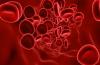 Aplastic anemia: Homeopathy, a better Solution
