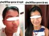 अजीबोगरीब बीमारी, लड़की के शरीर से पसीने की जगह निकलता था खून, होम्योपैथिक इलाज से हुई ठीक